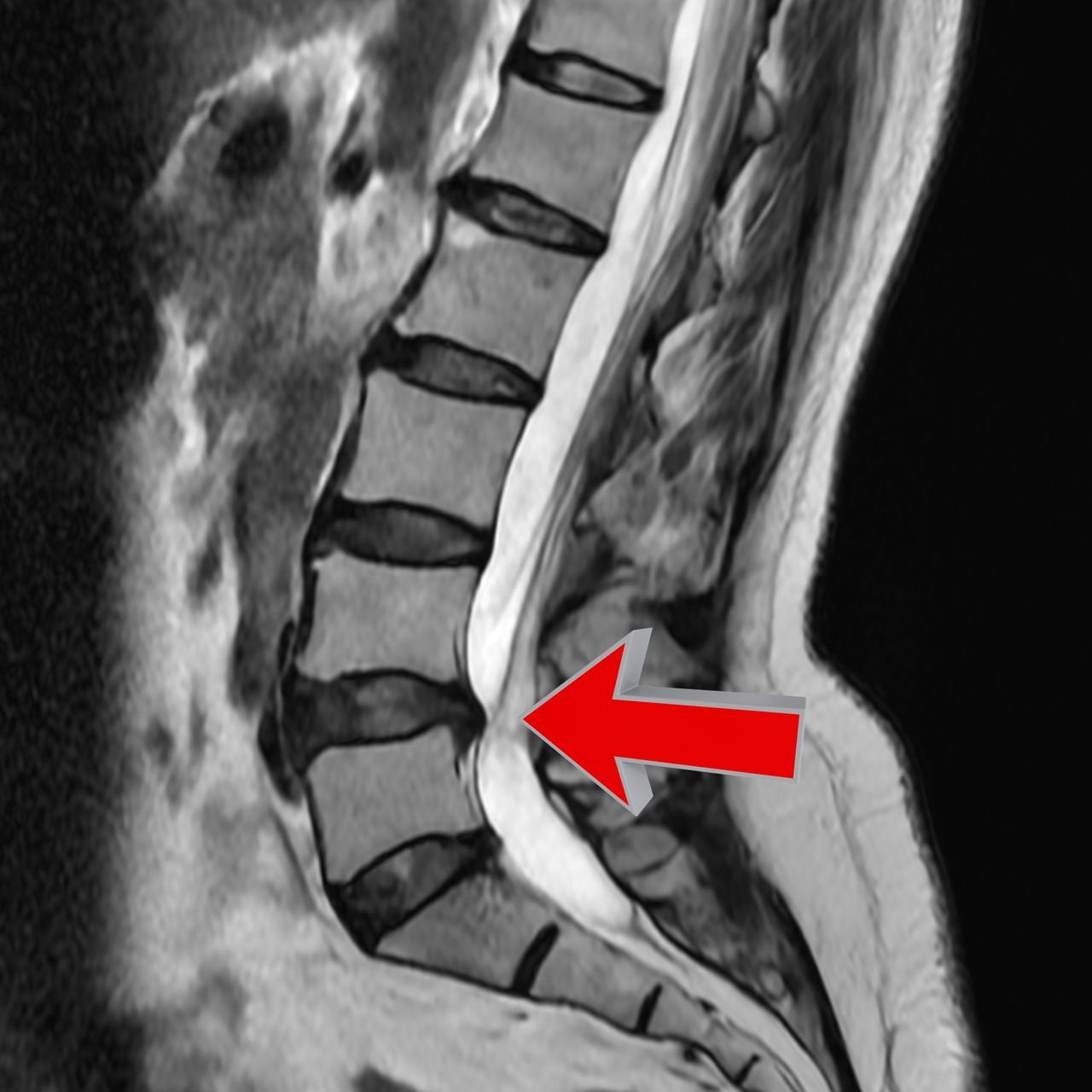 David Tafur Muñoz-2174