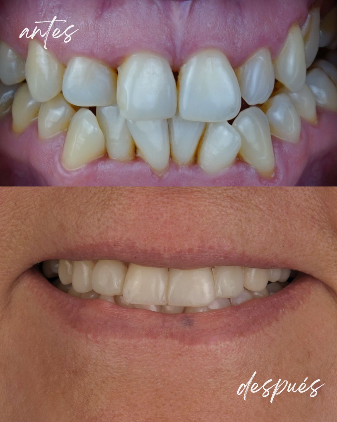 Nicolás Gallardo-10