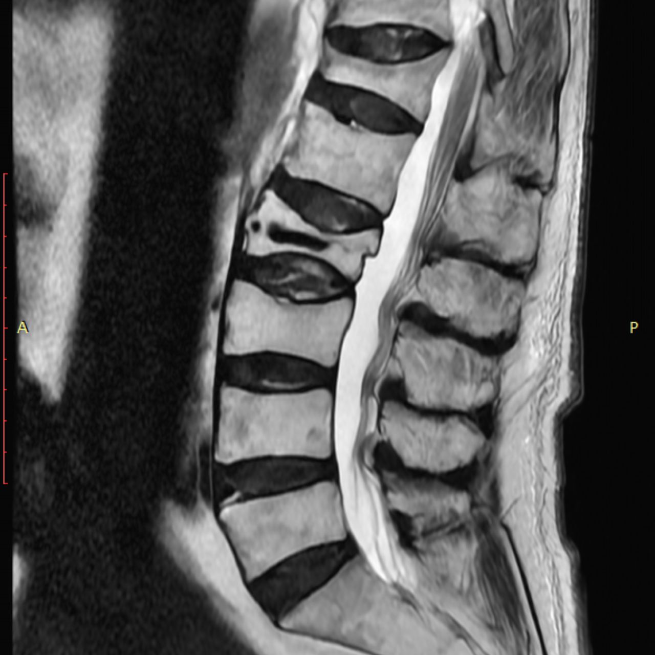 David Tafur Muñoz-1462