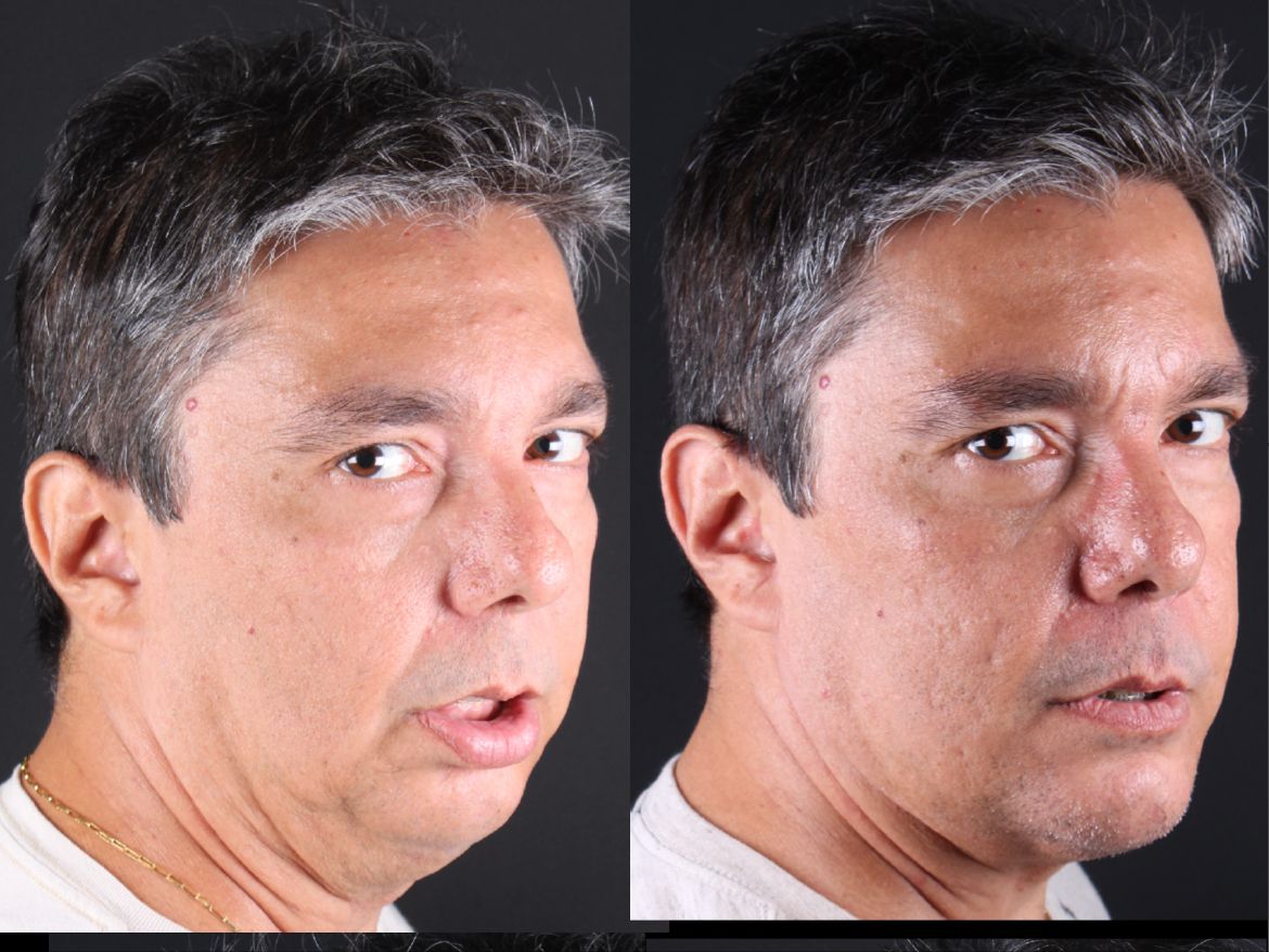 Frederico Carnevale-9