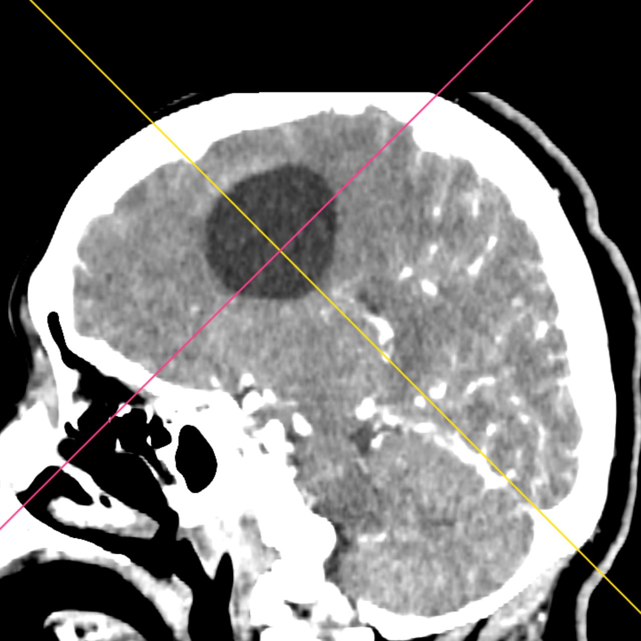 David Tafur Muñoz-1657