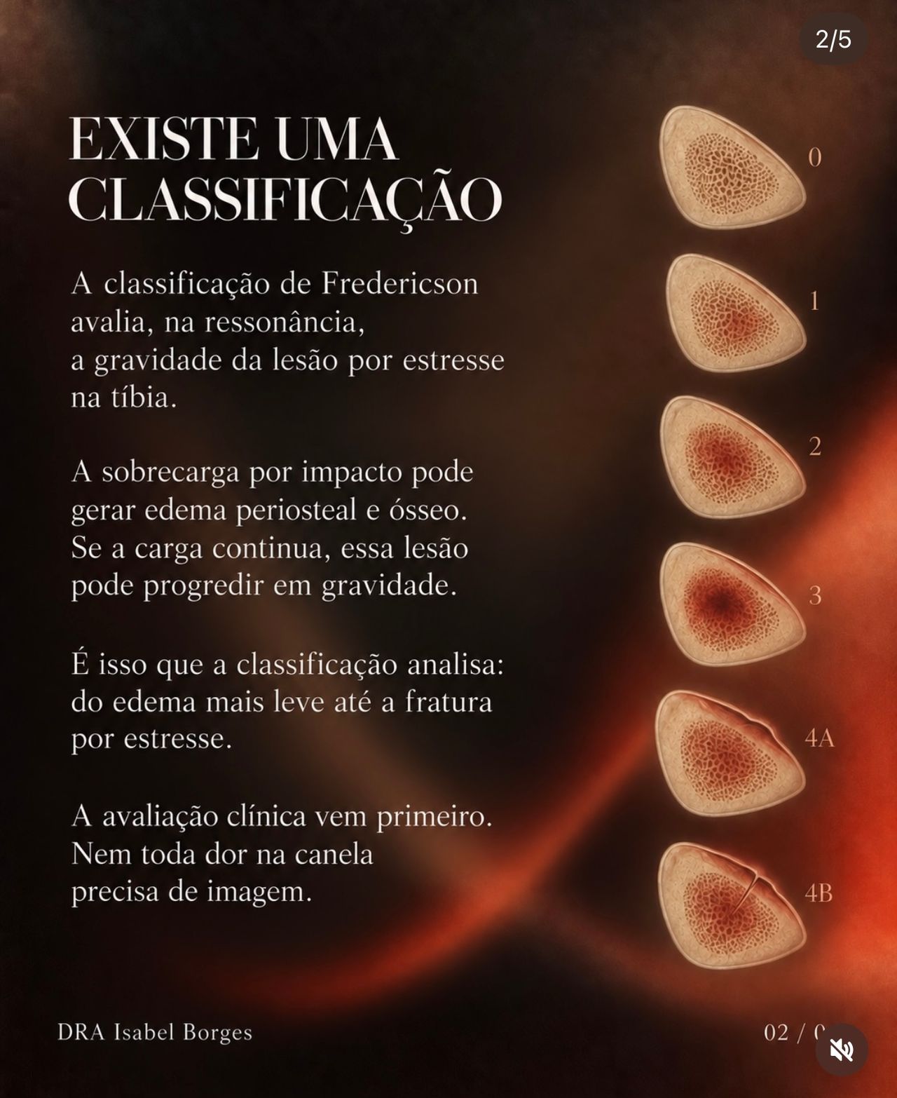 Isabel Araujo Borges-13
