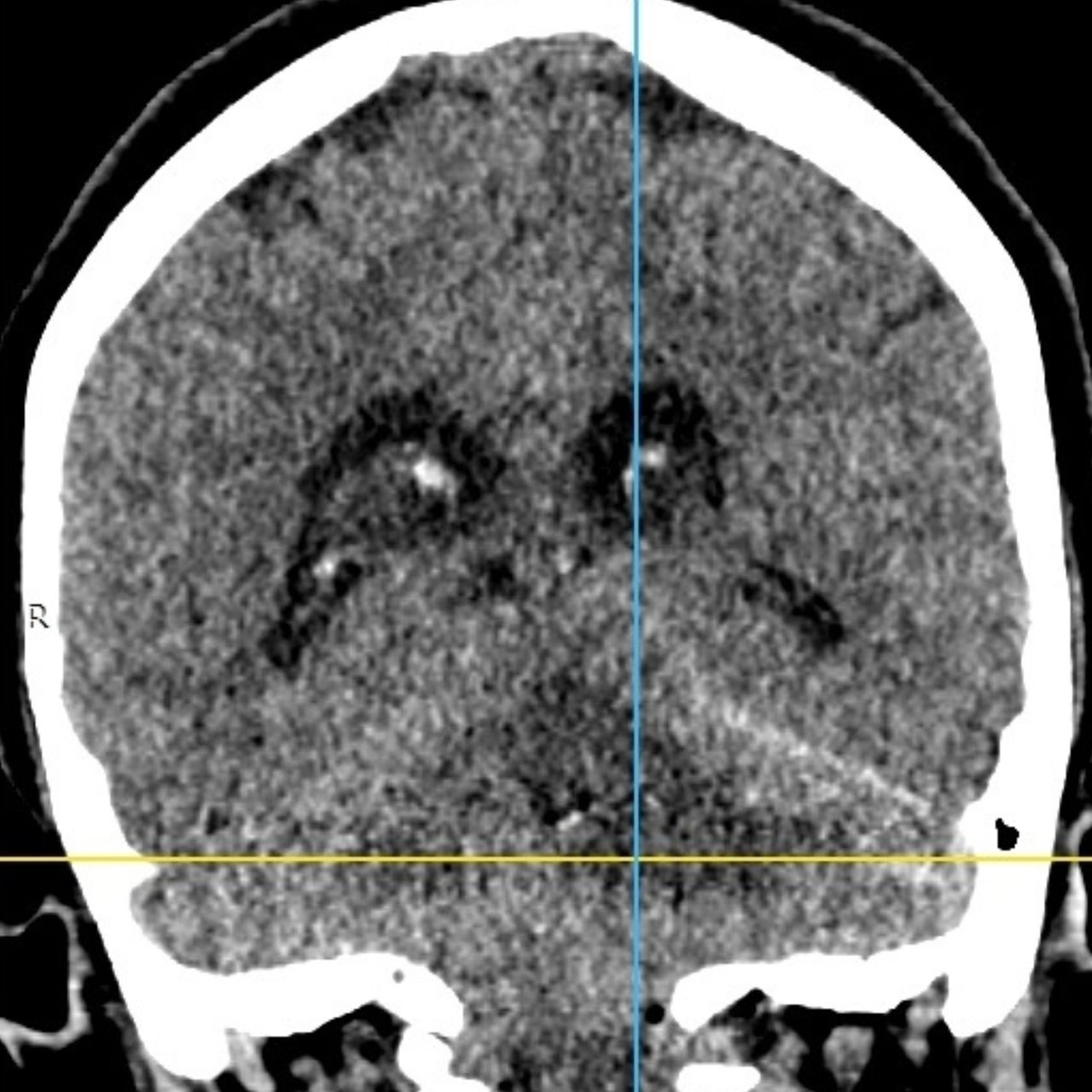 David Tafur Muñoz-1321