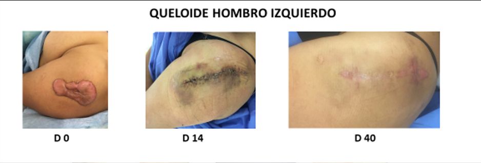 Jorge Schwember Fernandez-7