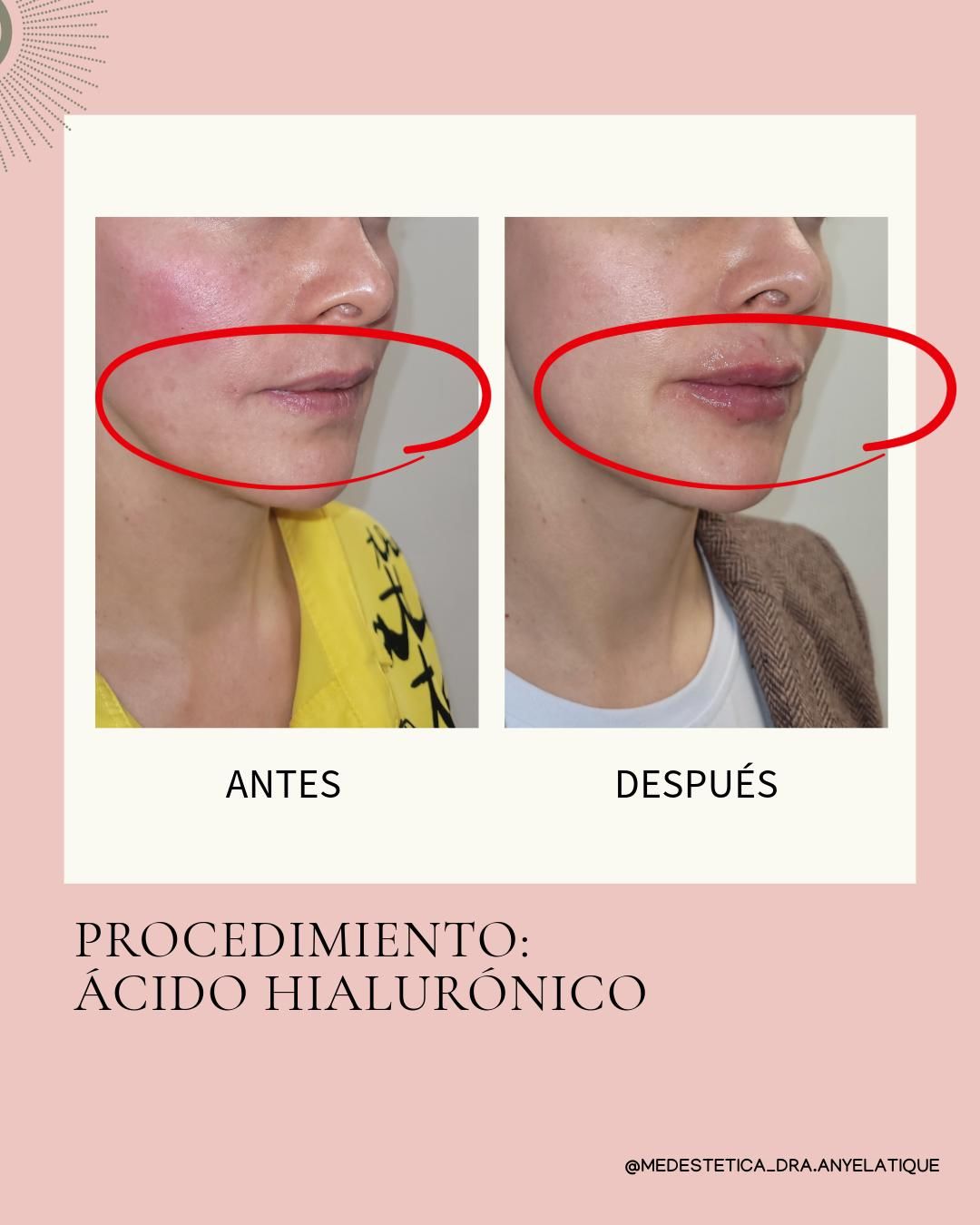 Anyela Tique Hilarión-5