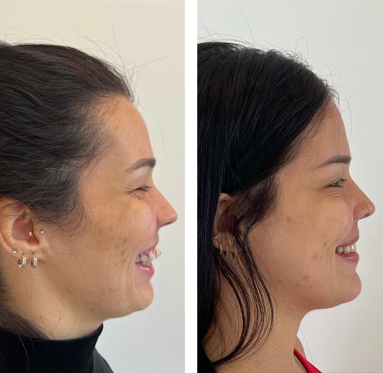 Daniel Assunção-16