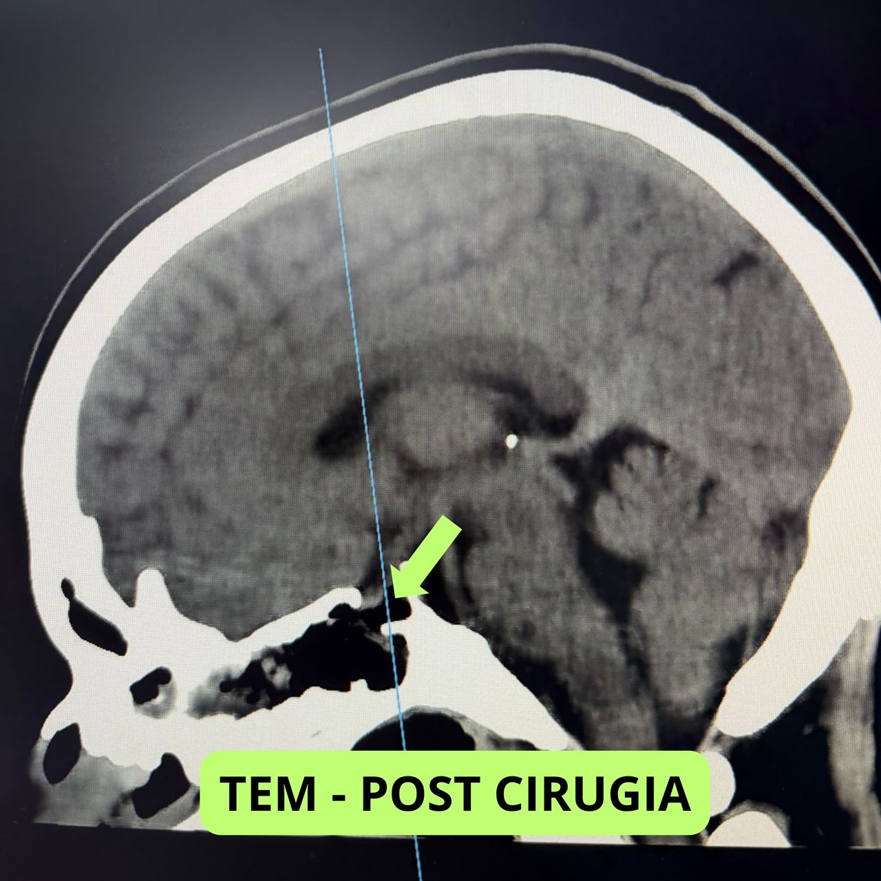 David Tafur Muñoz-2377