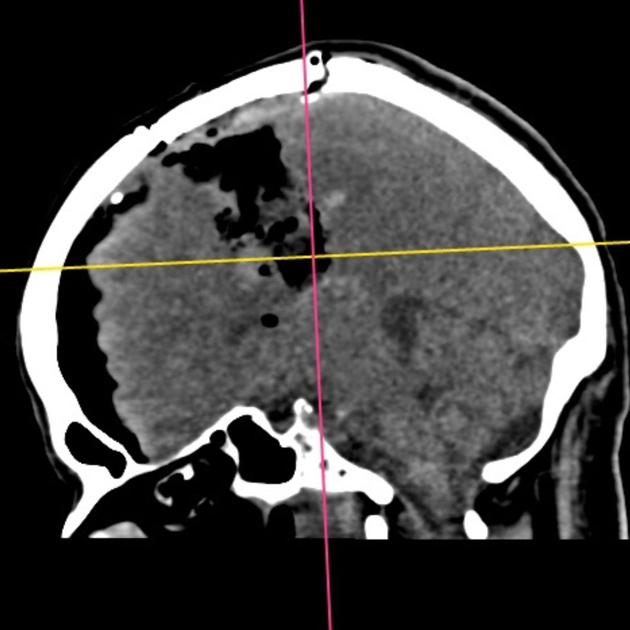 David Tafur Muñoz-1618