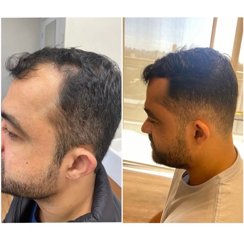 Millena Cavalcanti-0