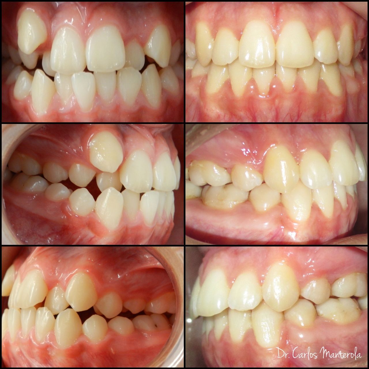 Carlos Manterola Marchant-13