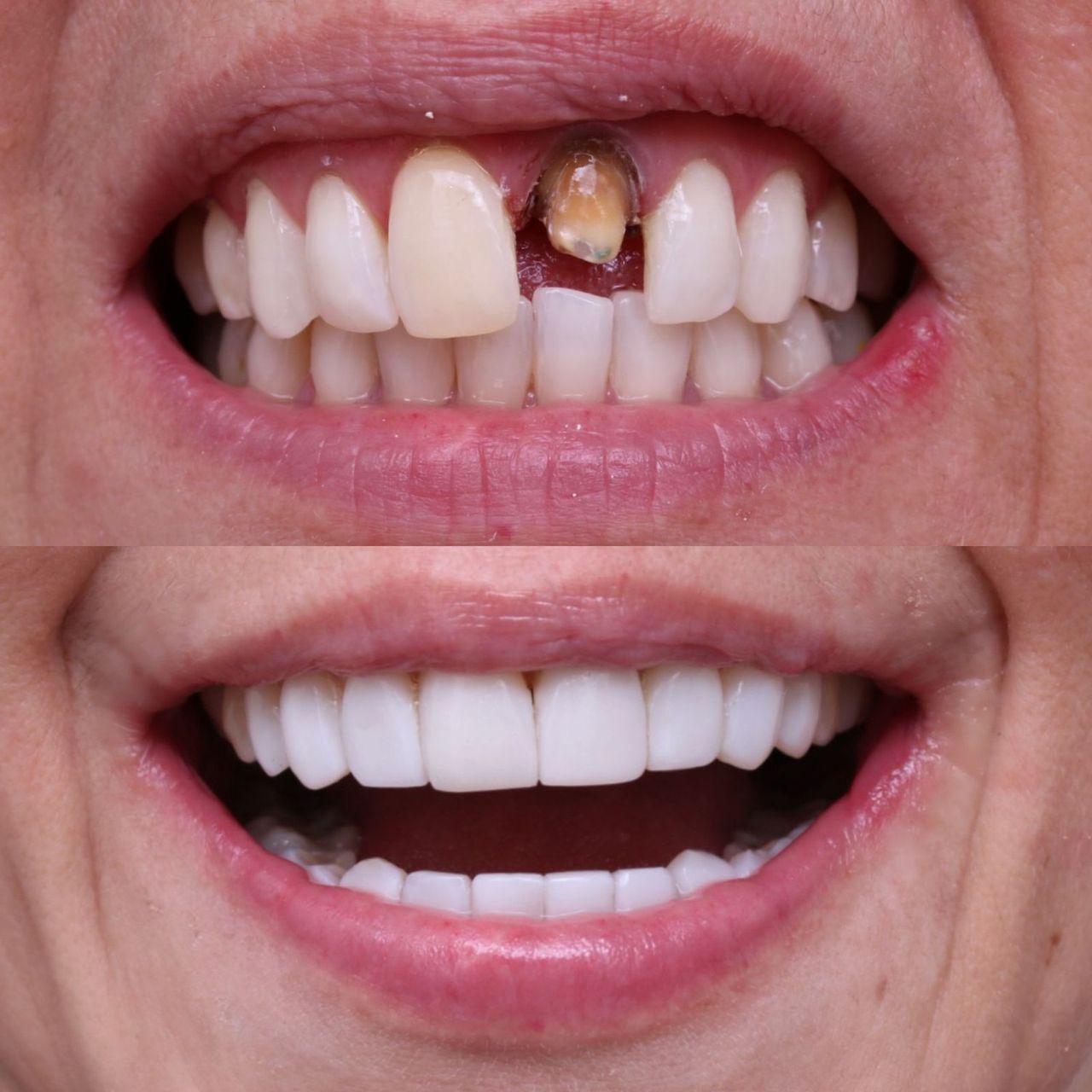 Santiago Gomez Urrego-3