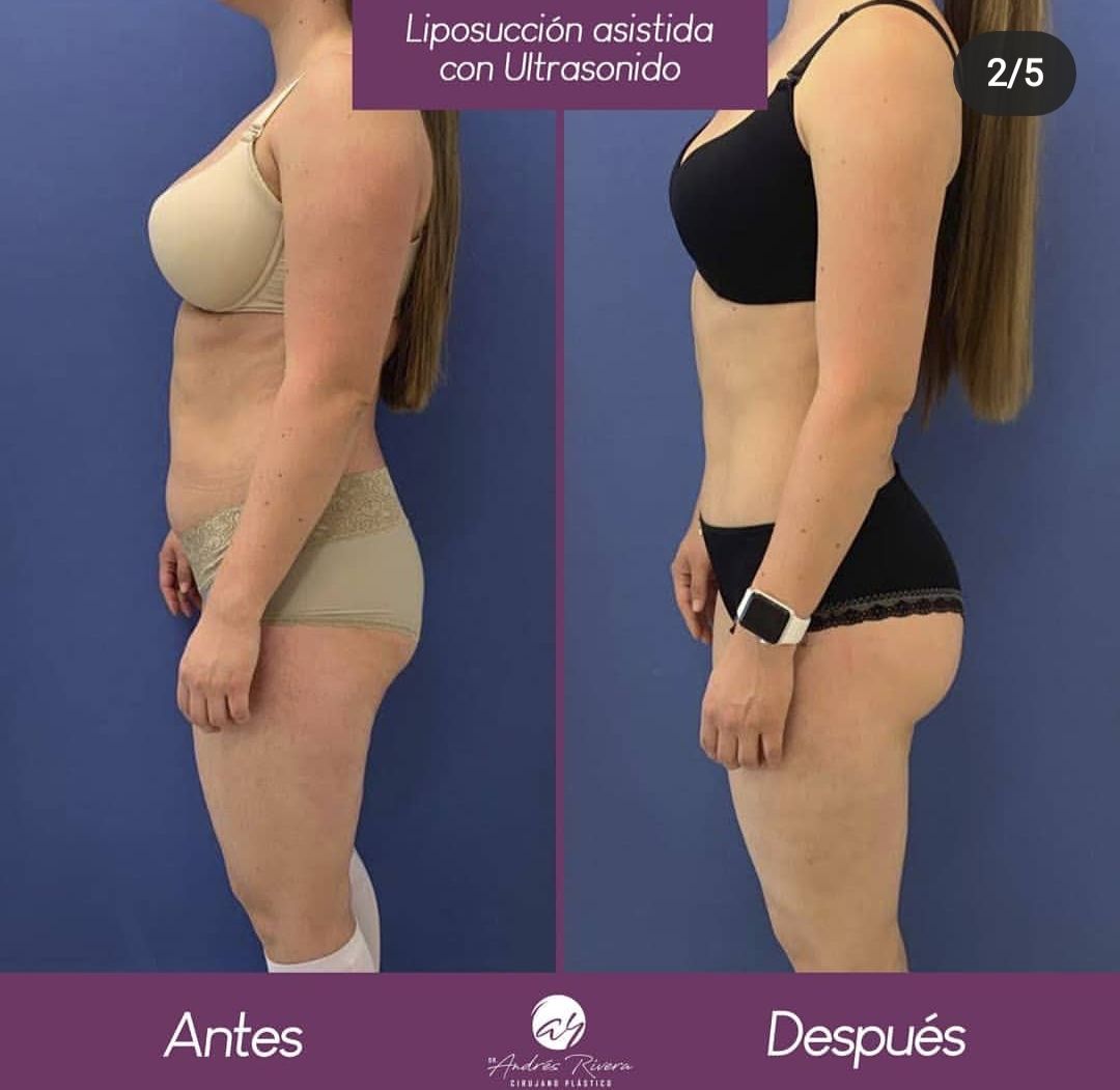 Andrés Rivera López-30