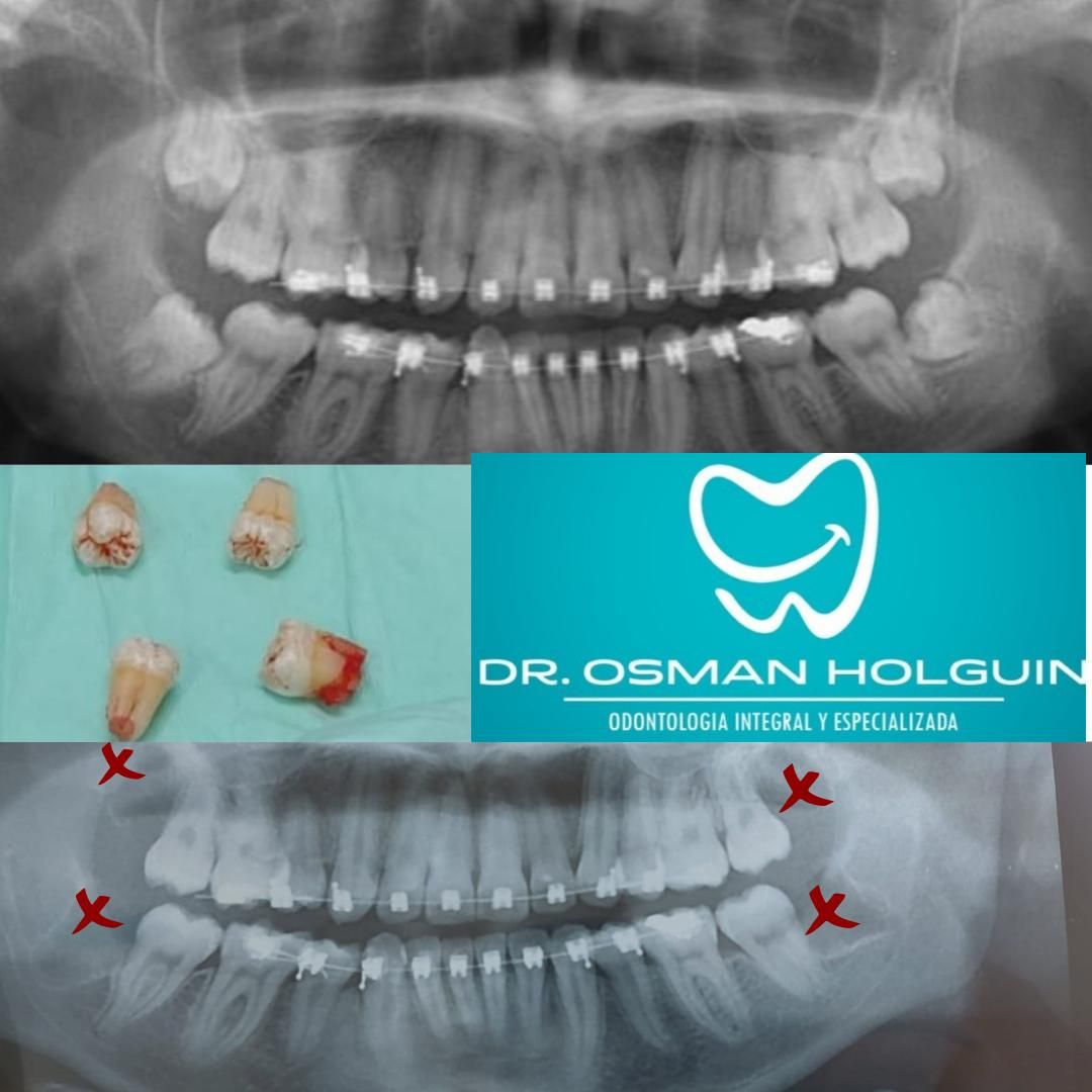 Osman Fernando Holguin Grisales-16