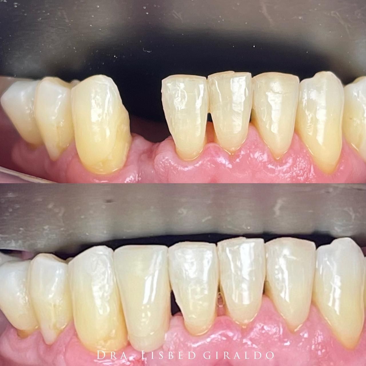 Lisbed Giraldo Olarte-21