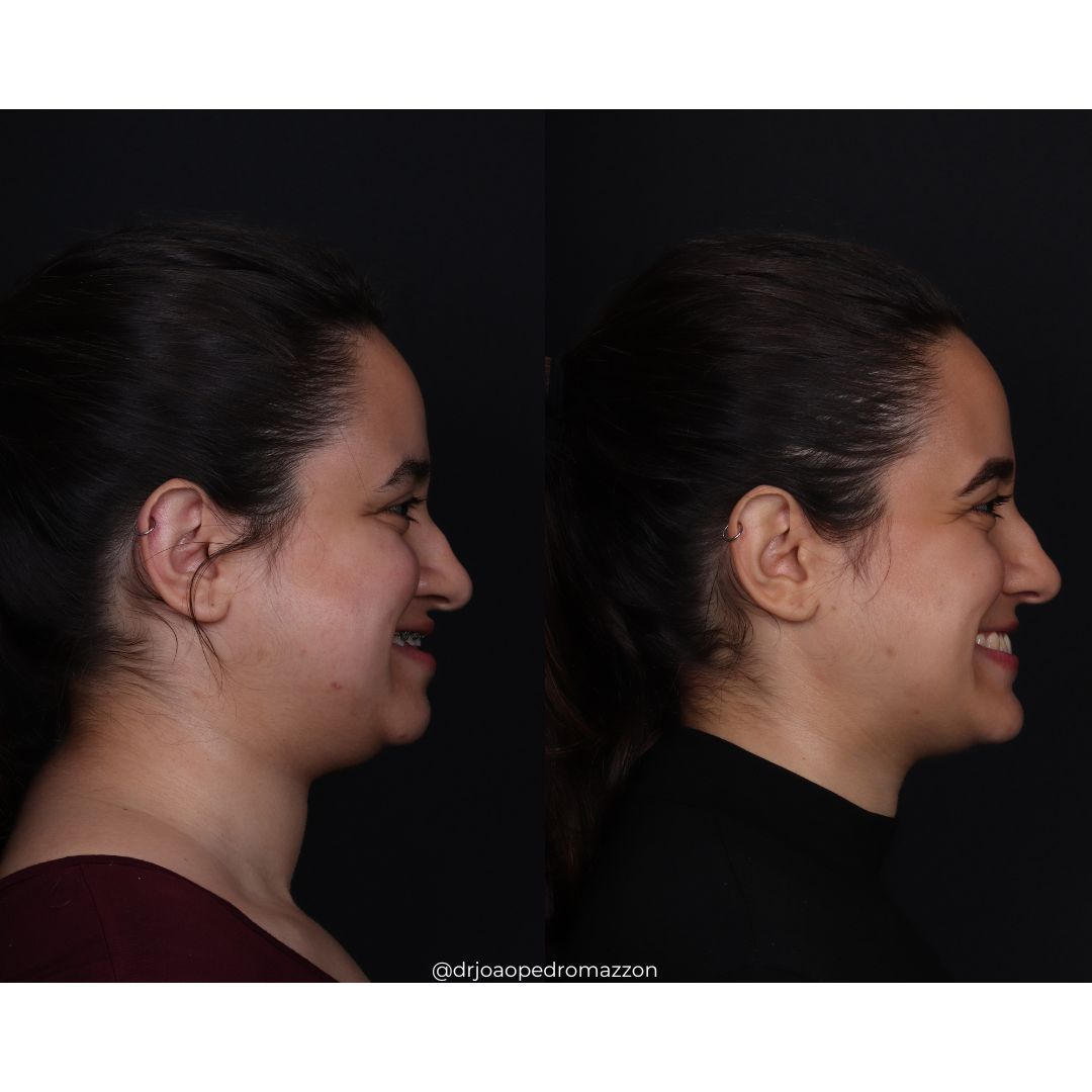 João Pedro Paulino Mazzon-66