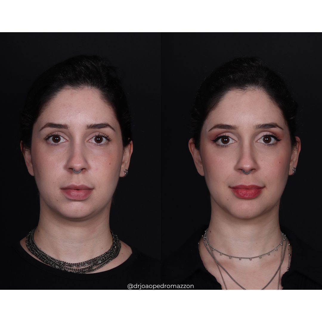 João Pedro Paulino Mazzon-22