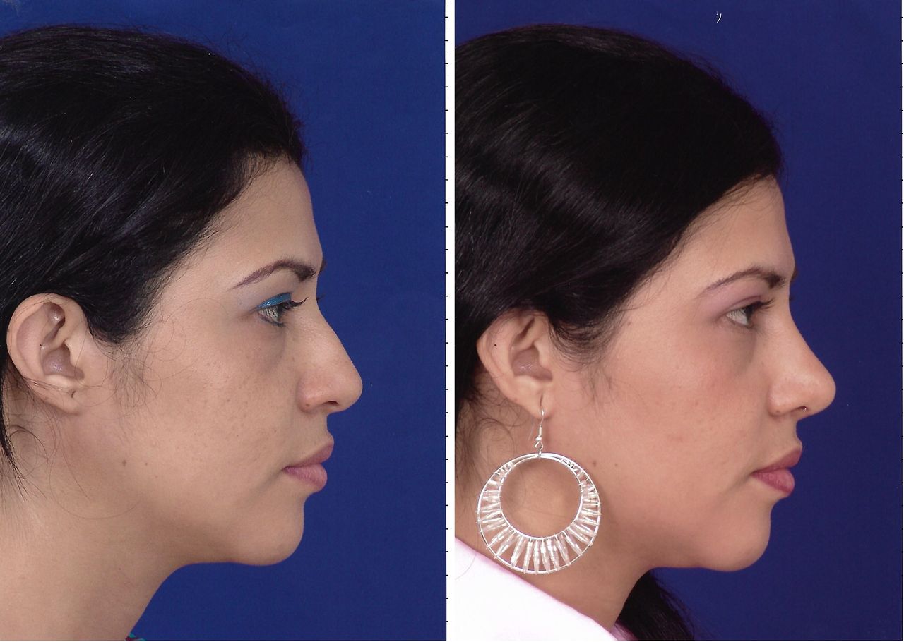 Jorge A Holguin Ruiz-38