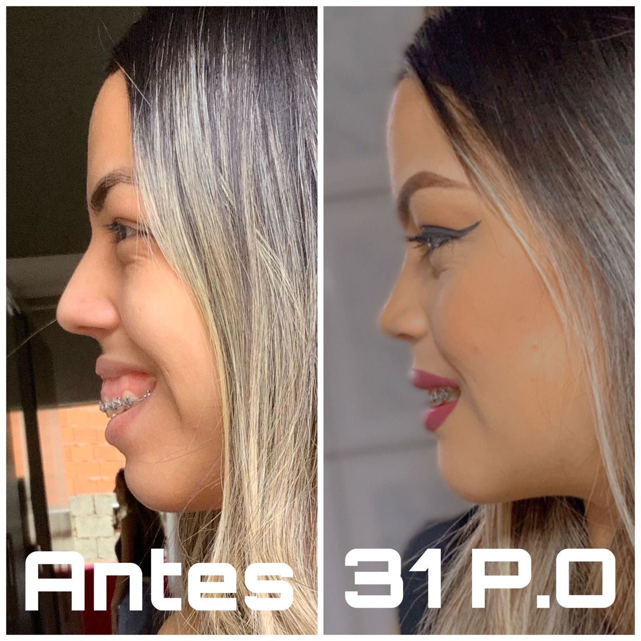 Bruno Nifossi Prado-31