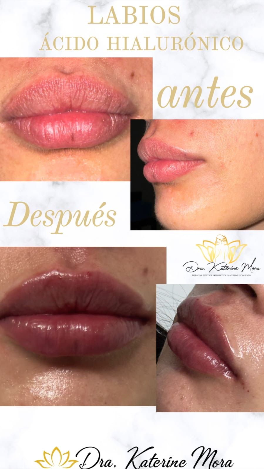 Katerine Mora Cardenas-3