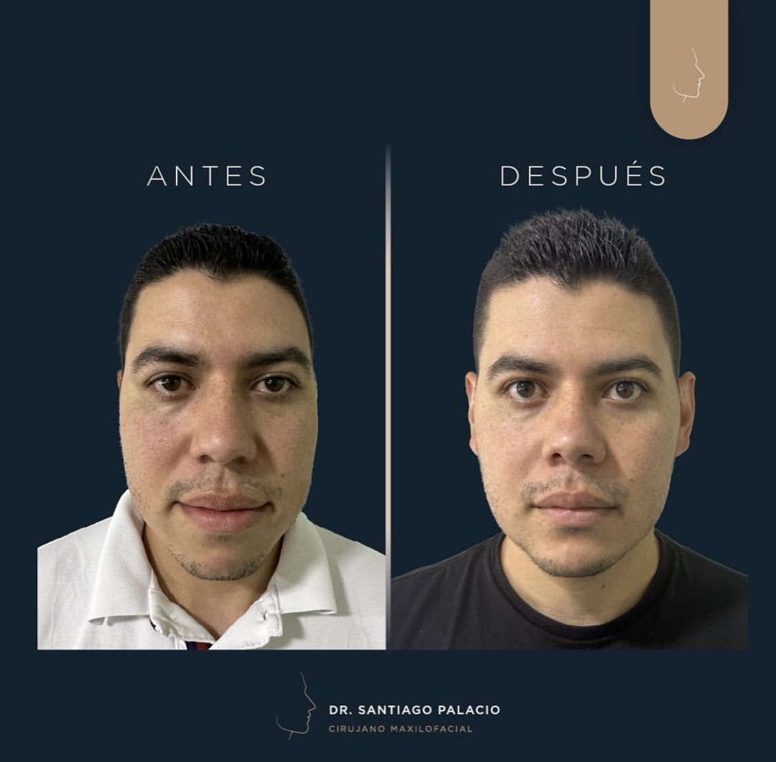 Santiago Palacio Gutierrez-5