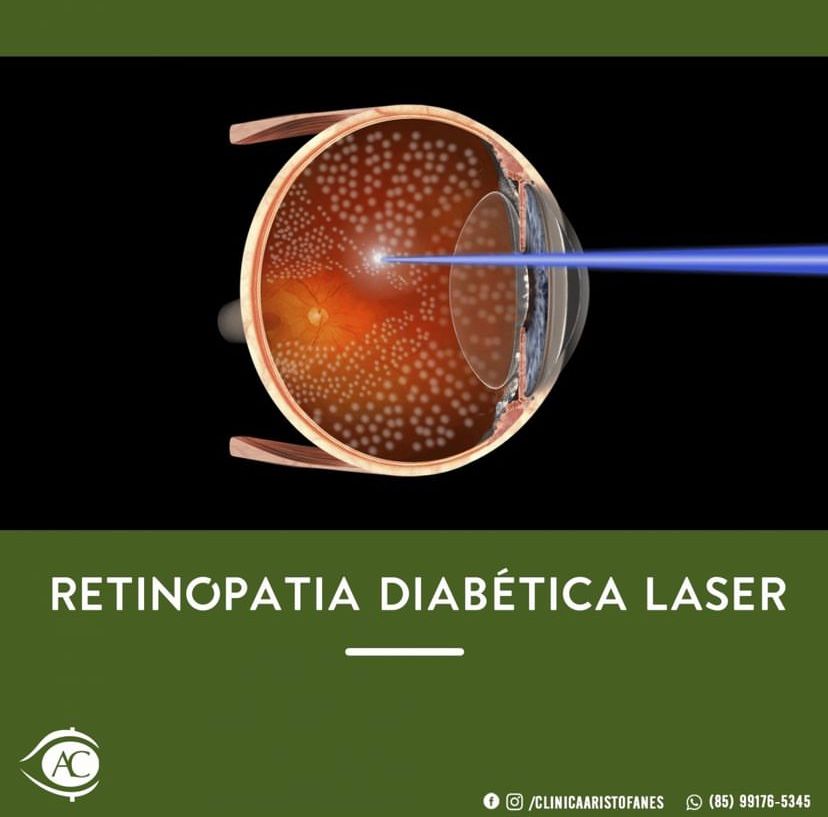 Aristófanes Canamary Jr.-7