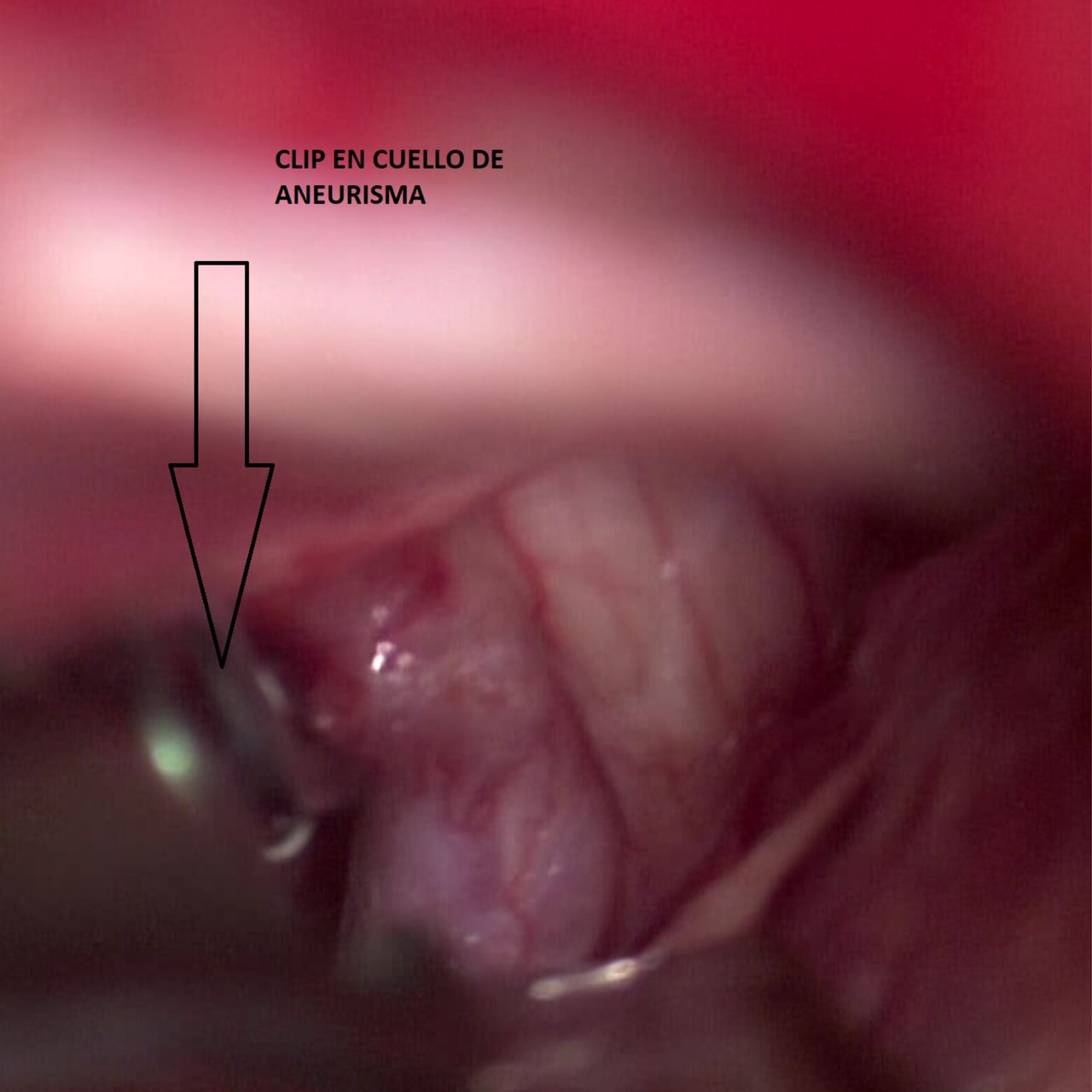 David Tafur Muñoz-1247