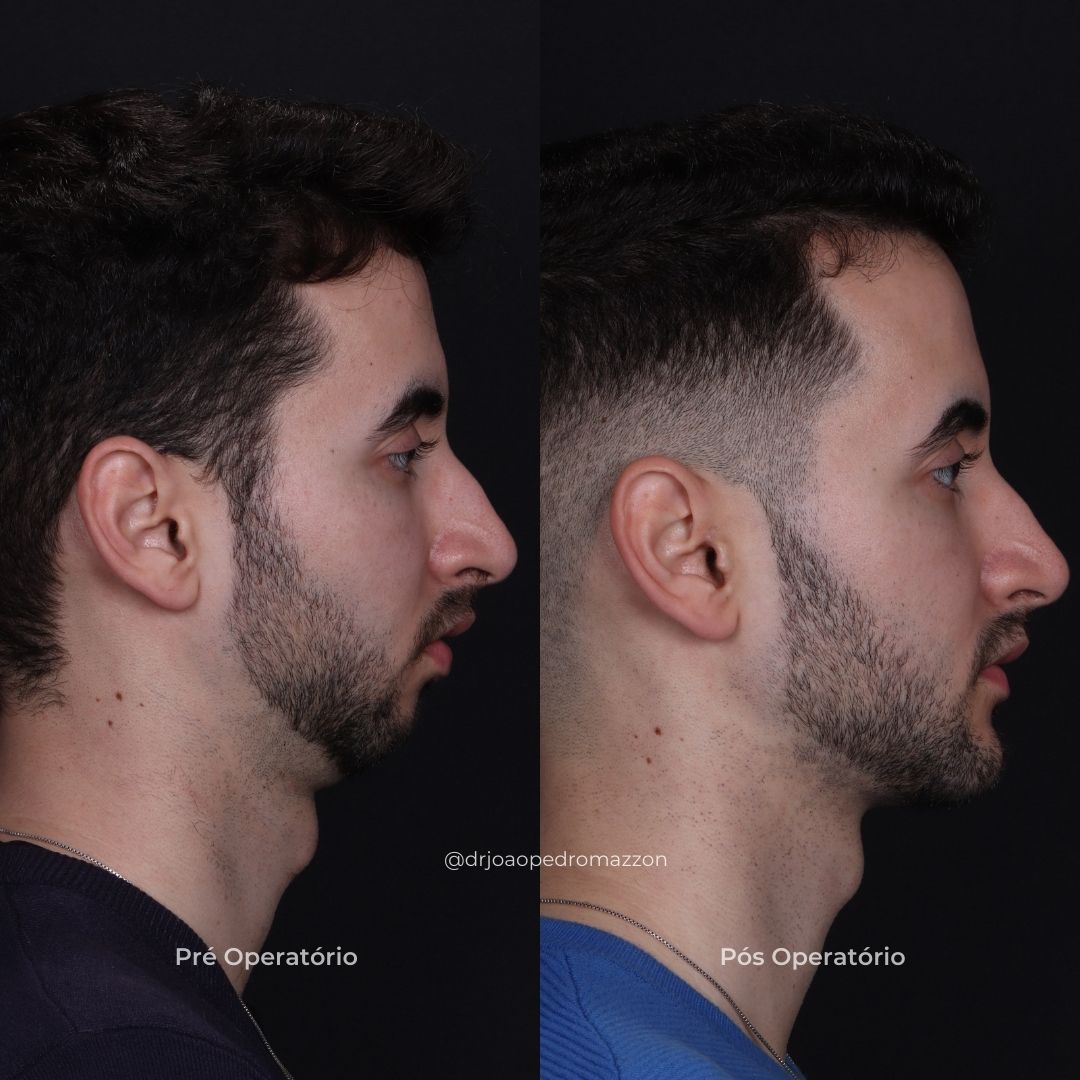 João Pedro Paulino Mazzon-73