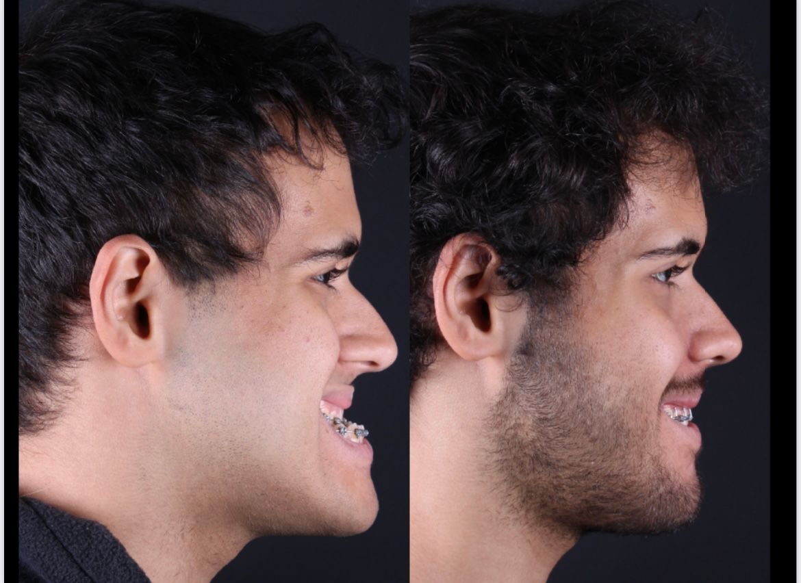 Frederico Carnevale-11