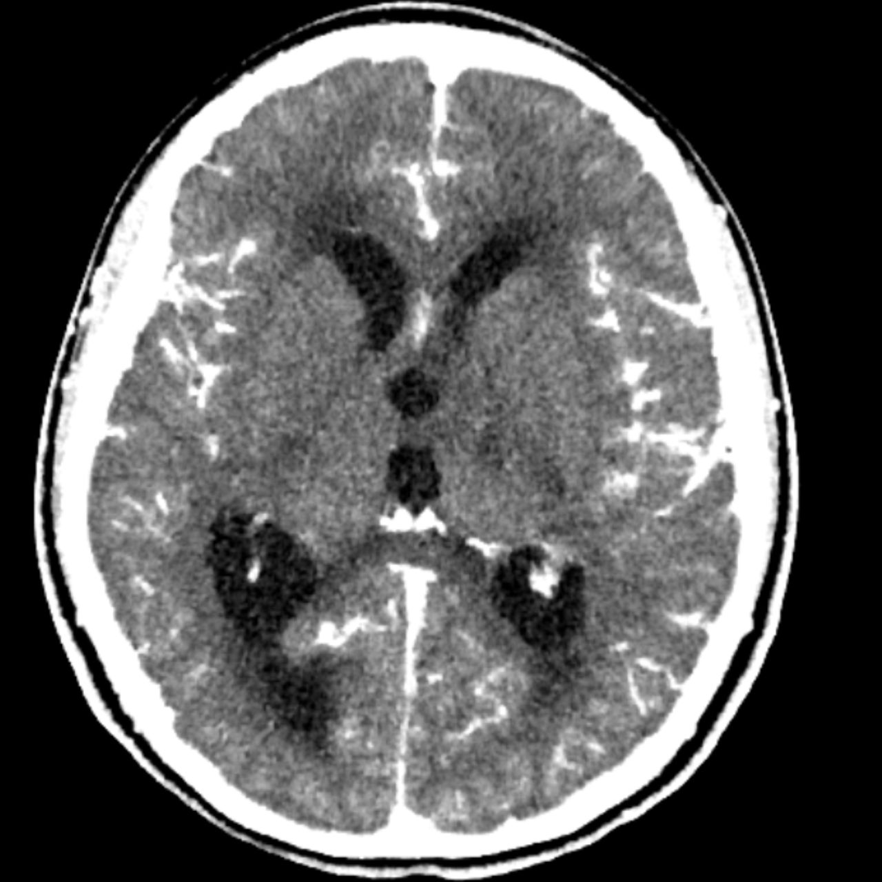 David Tafur Muñoz-1524