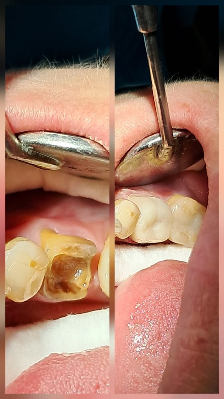 Yuset Almeida Urquiaga-4