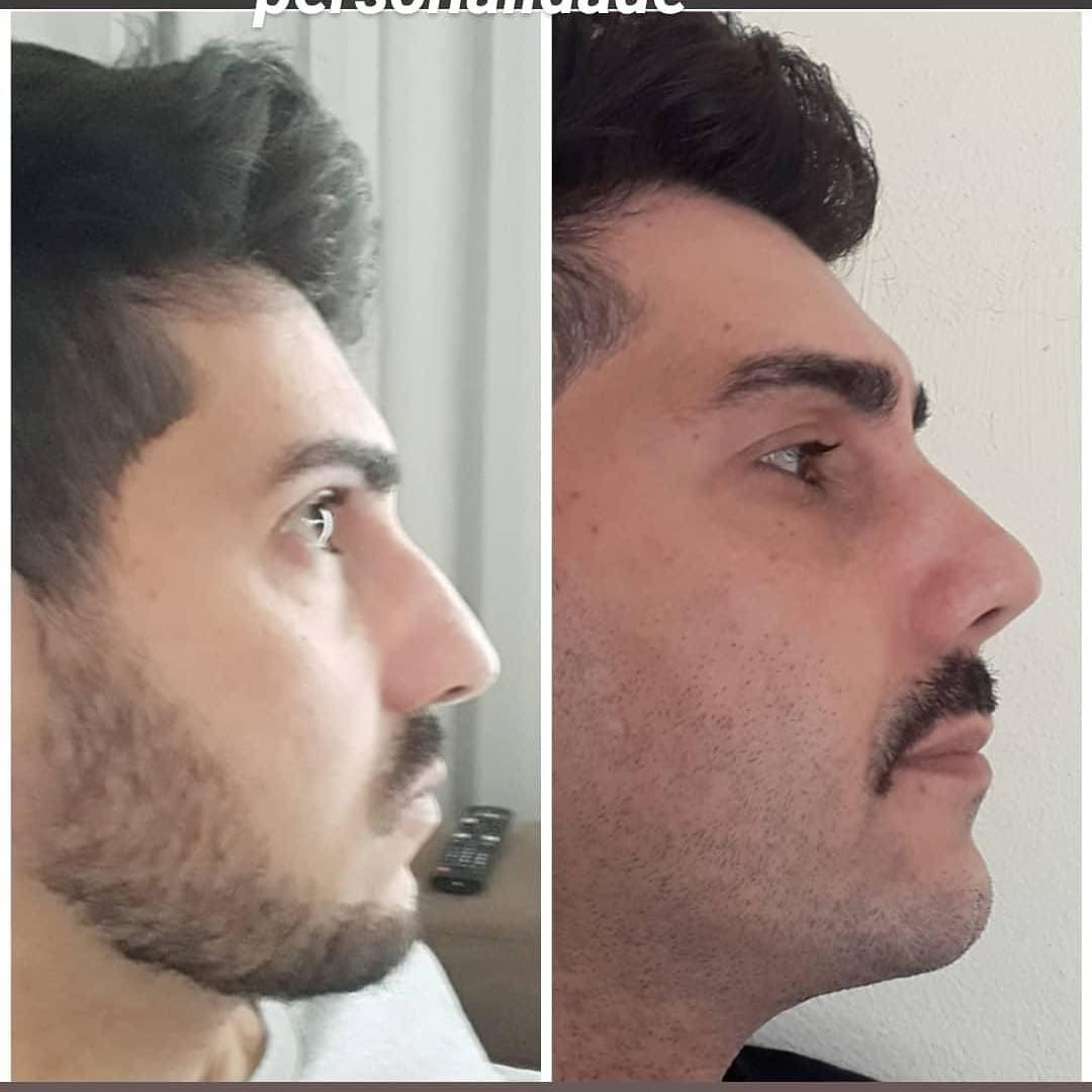 Augusto Cesar Borges-6