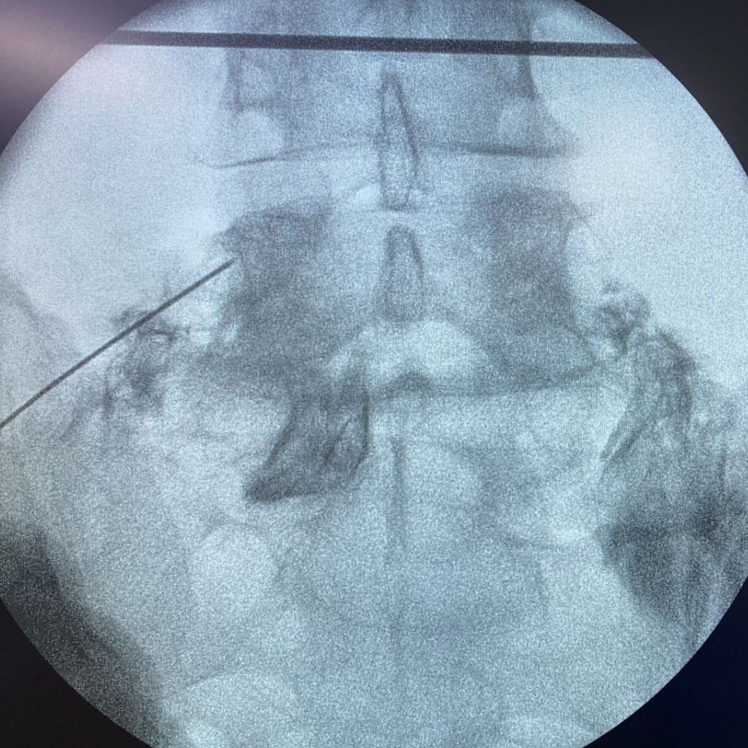 David Tafur Muñoz-2154