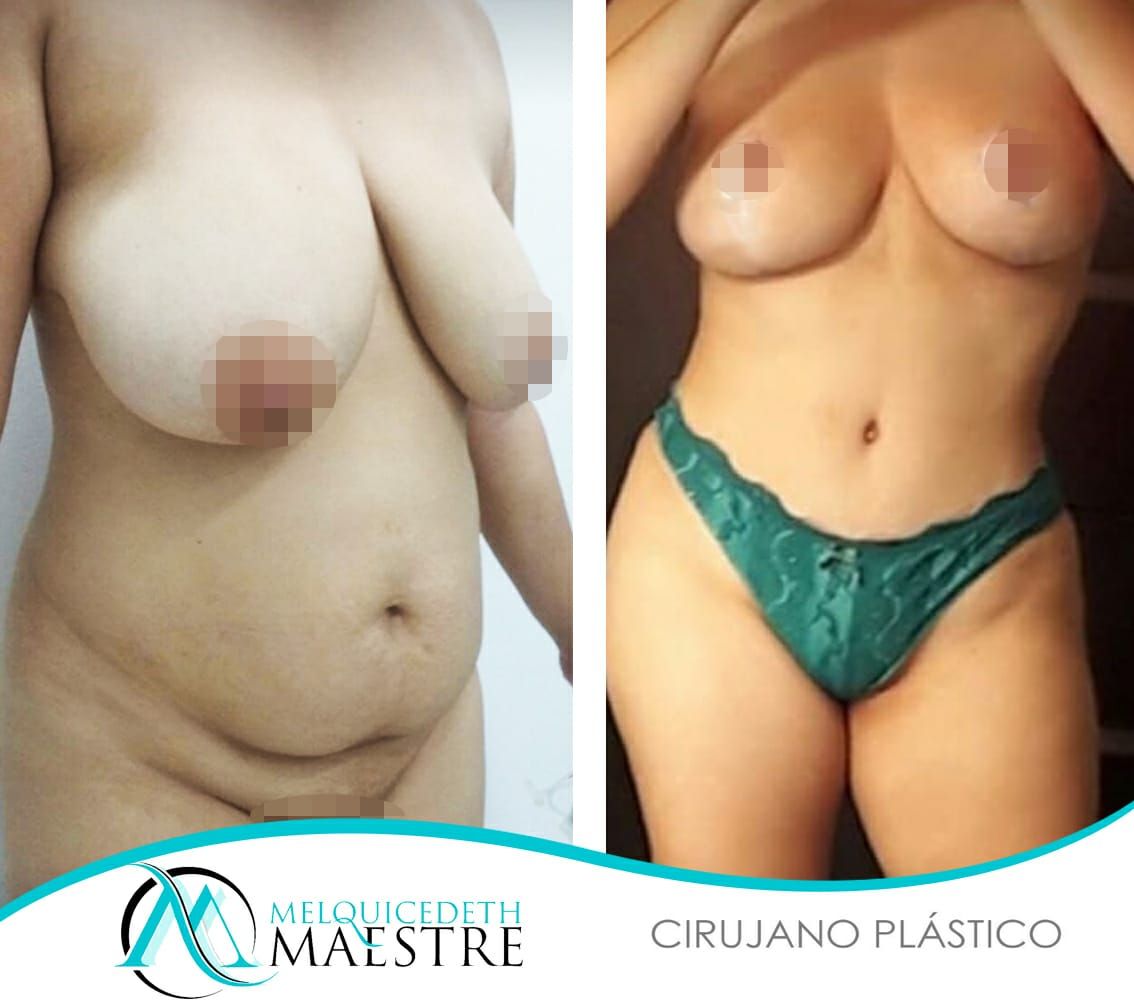 Melquicedeth Maestre-3