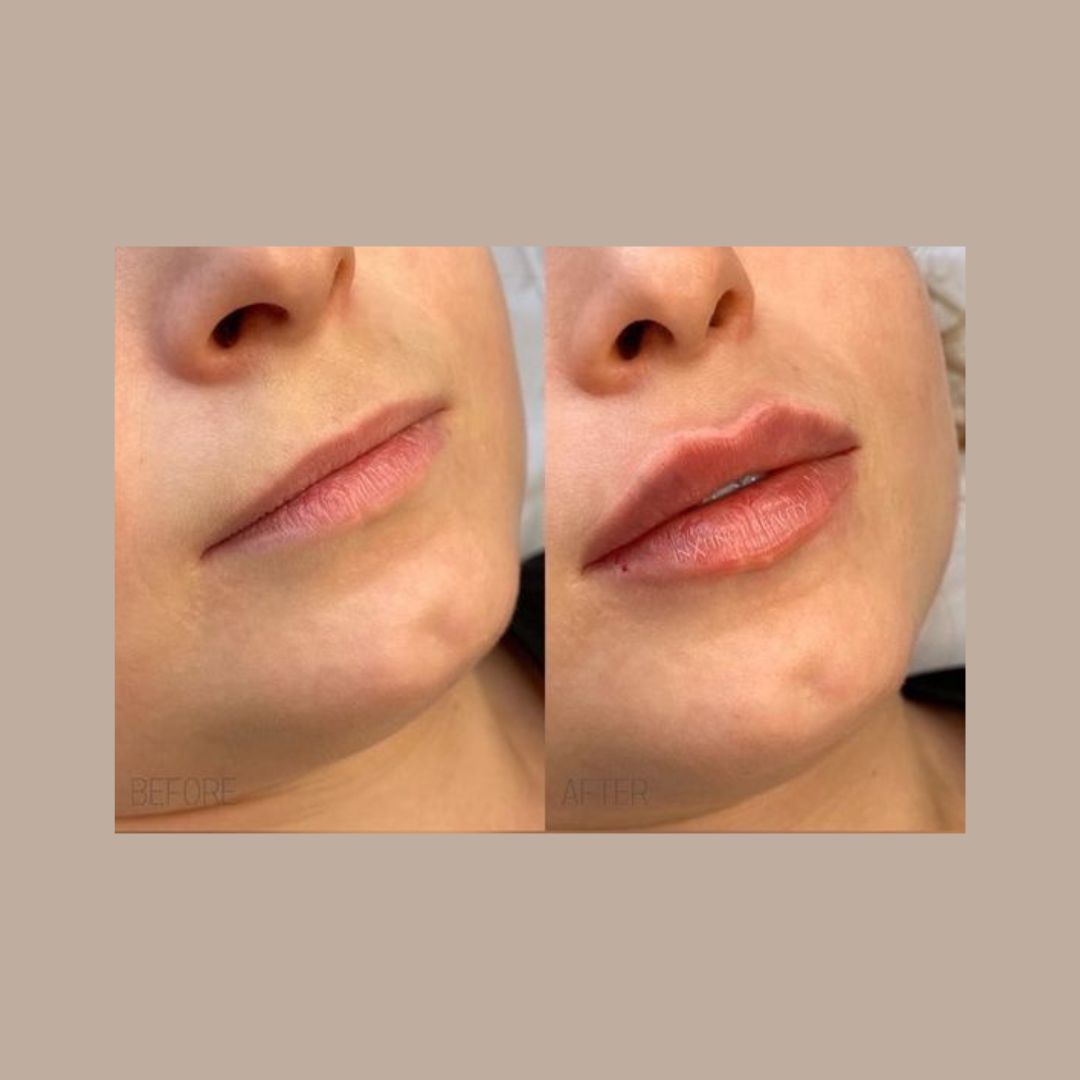 Mónica Hernandez Bulla-13