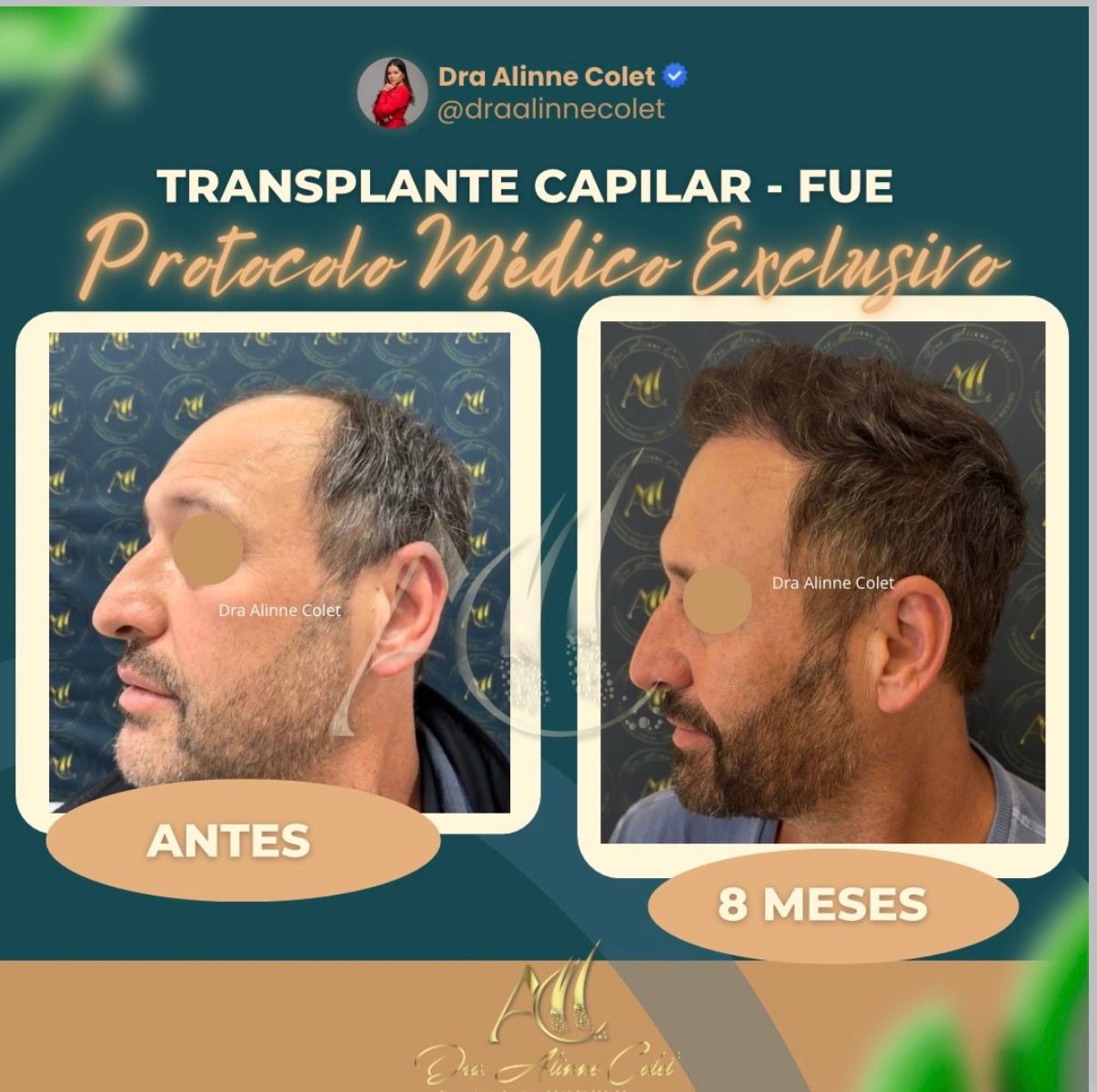 Alinne Gerssica Soares Colet-8