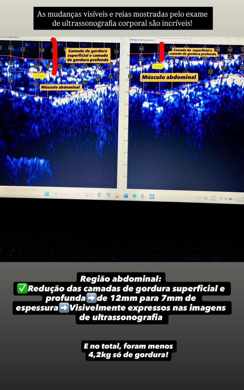Raquel Alves-14