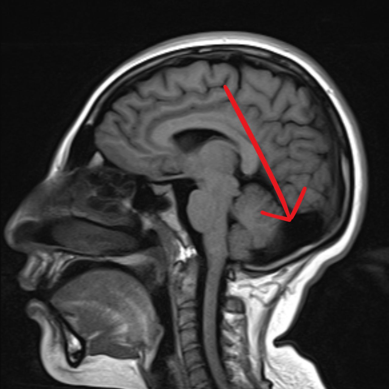 David Tafur Muñoz-1590