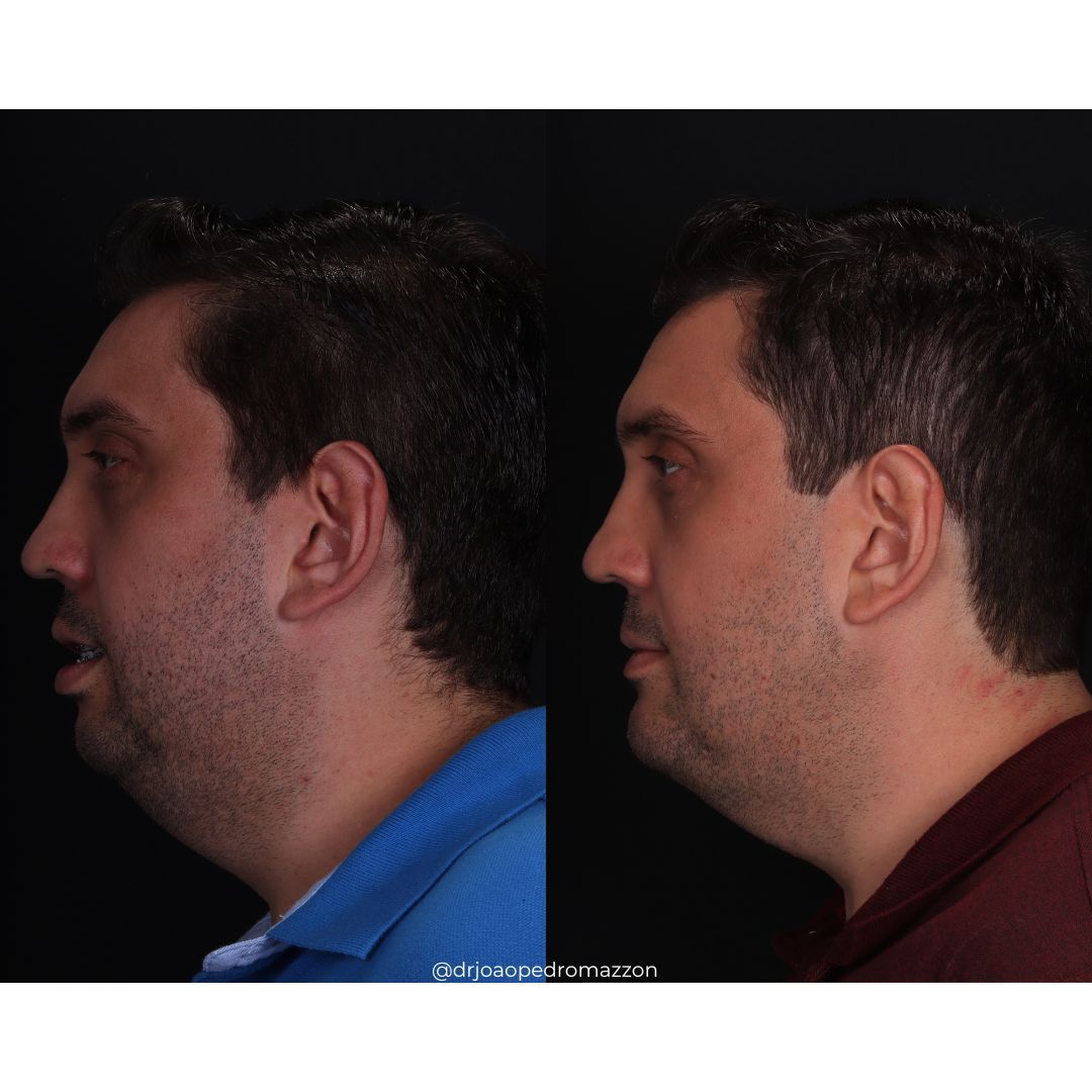 João Pedro Paulino Mazzon-34