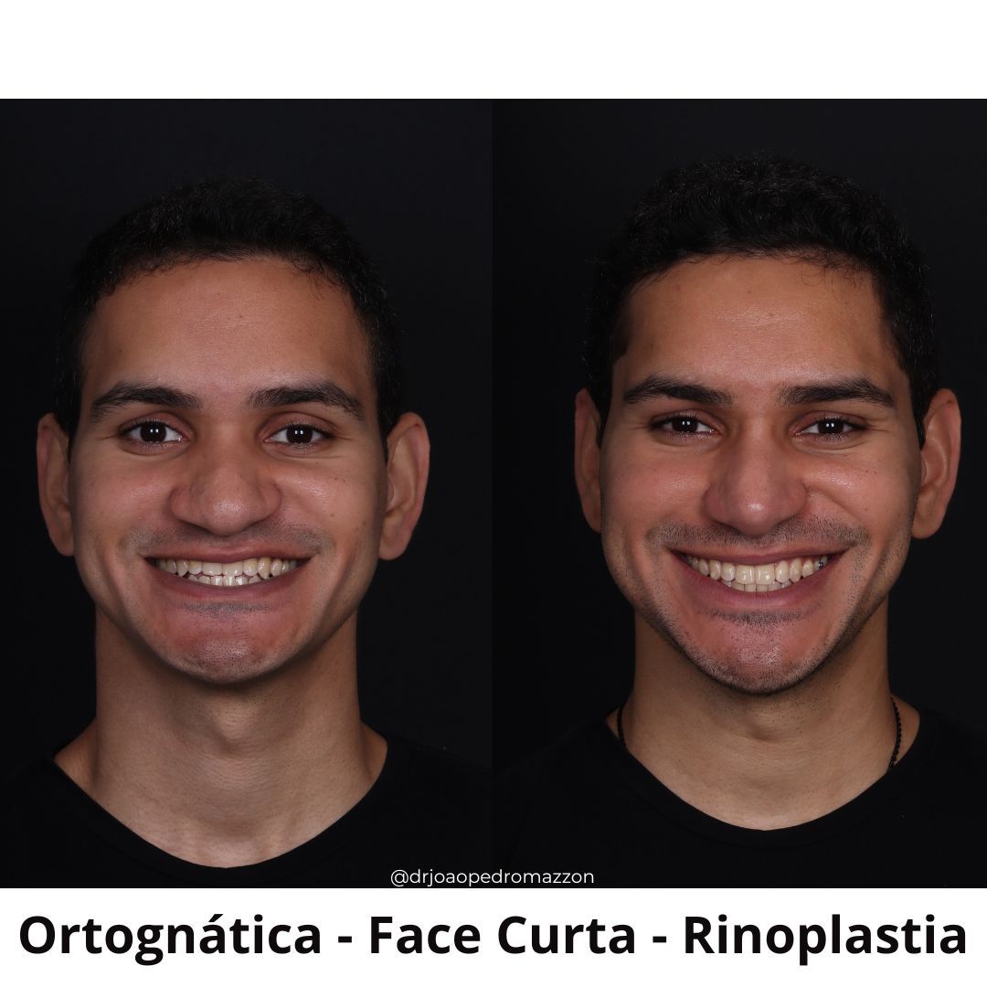 João Pedro Paulino Mazzon-13