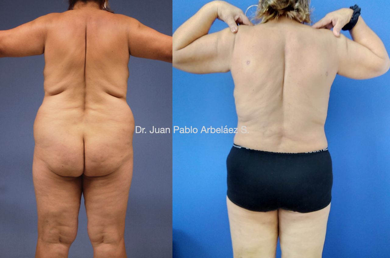 Juan Pablo Arbeláez Sierra-39