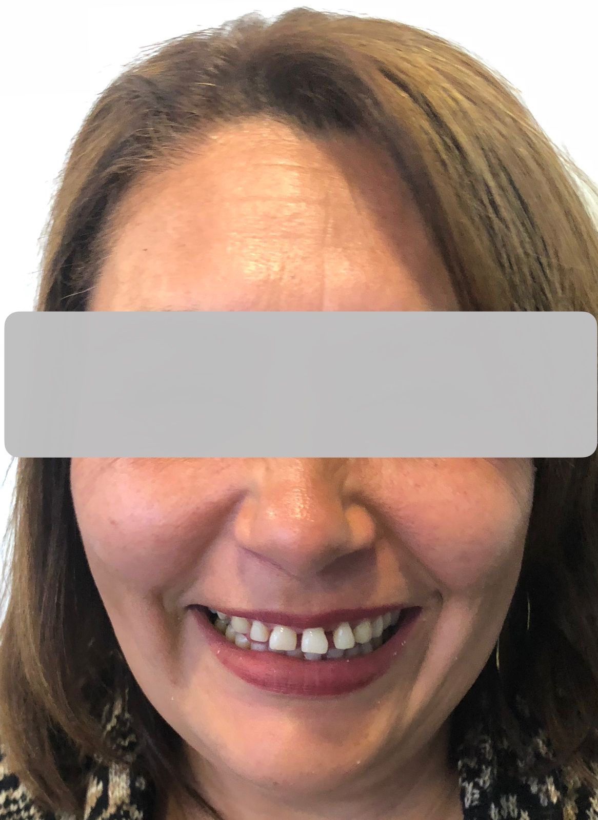 Luciano Varas Salinas-24