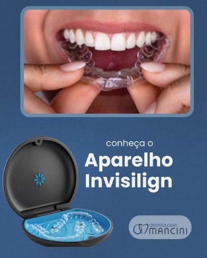 Hermenegildo Mancini-6