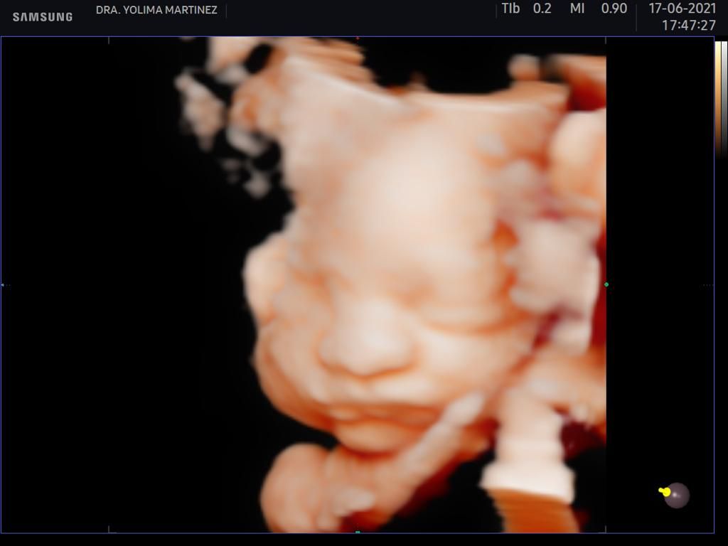 Mercy Yolima Martínez Velásquez-3