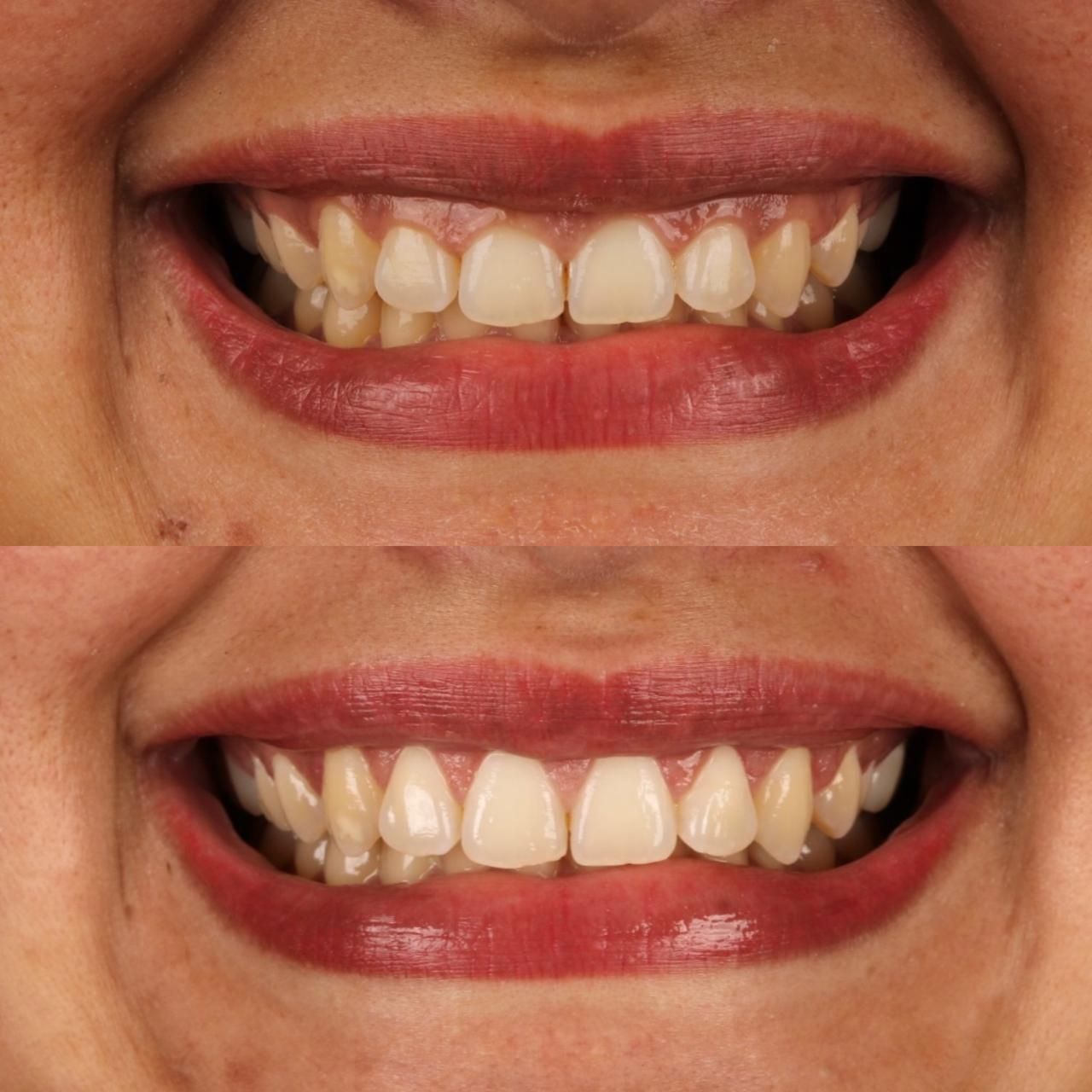 Gabriel Lucio Calazans Duarte-5