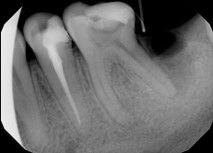 Hernán Andrés Febre Moscoso-11