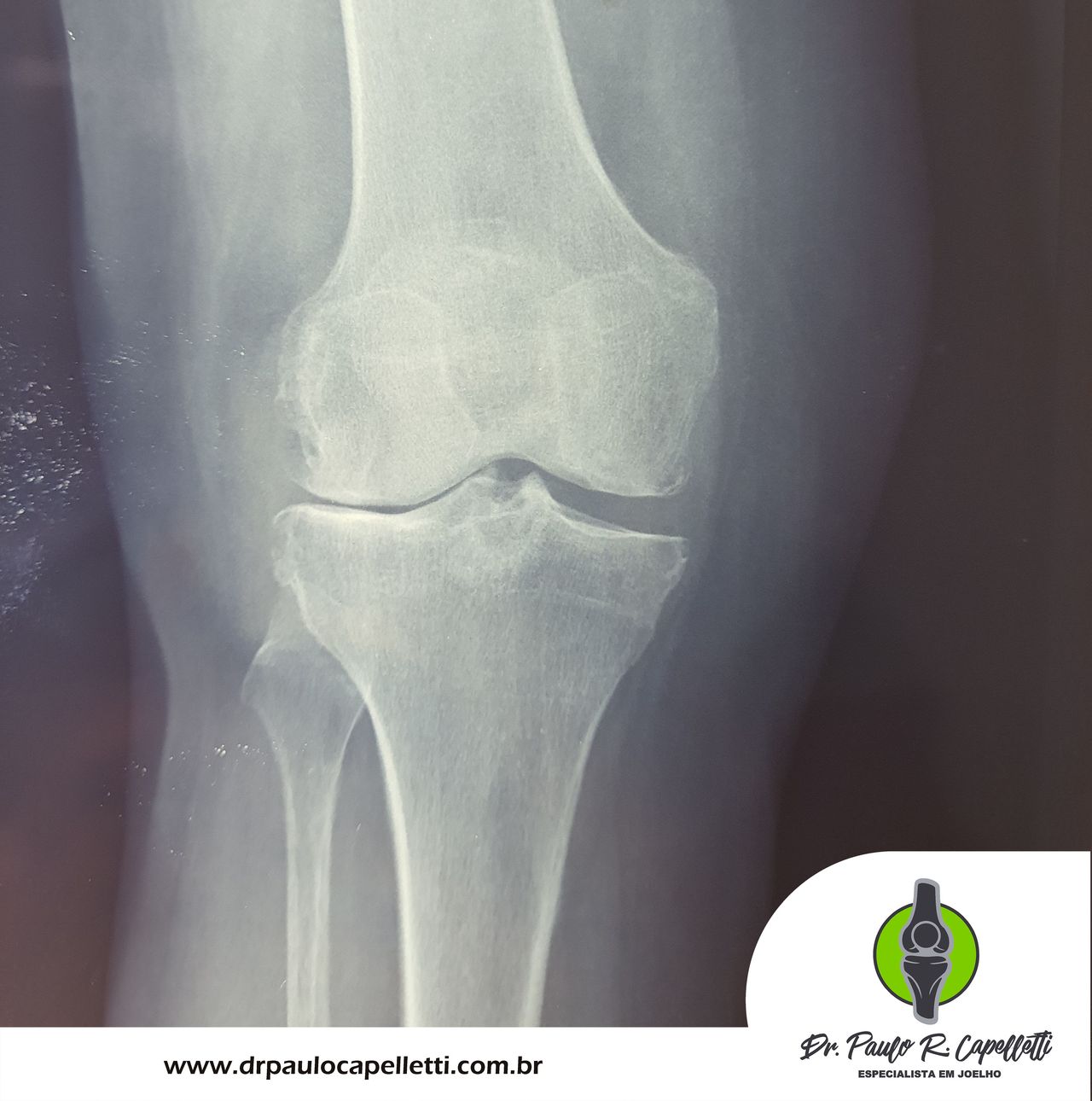 Paulo Roberto Capelletti-51