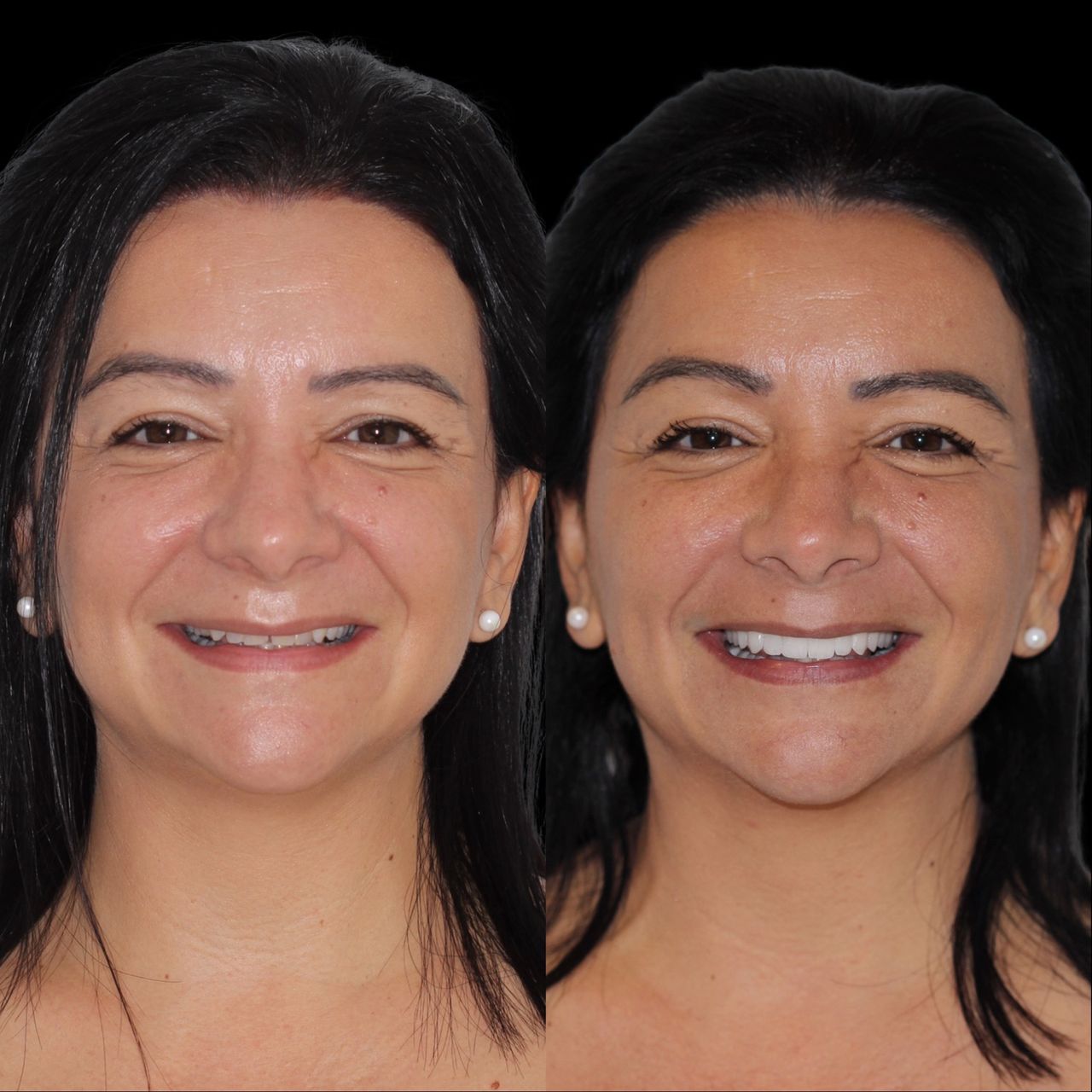 Caroline Benedeti-23