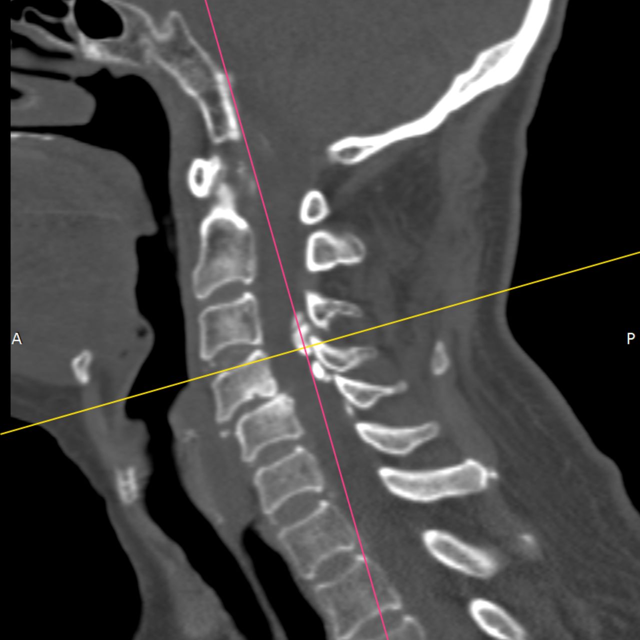 David Tafur Muñoz-1902