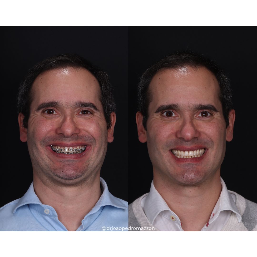 João Pedro Paulino Mazzon-47