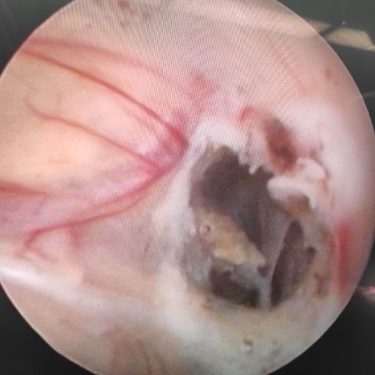 David Tafur Muñoz-1223